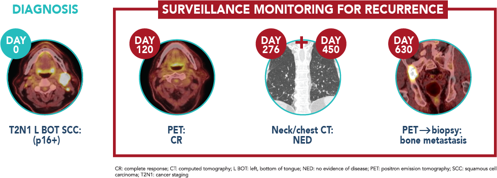 Surveillance Monitoring